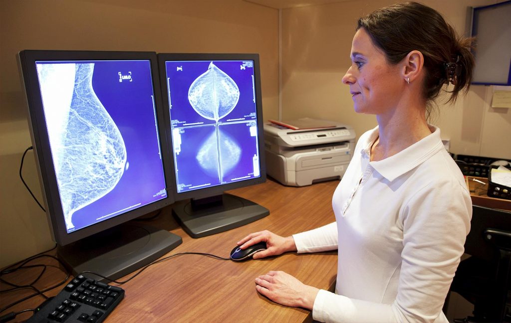 Gynecological Imager examining Breast Imaging on her computer